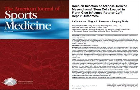 연세사랑병원 어깨관절 줄기세포 연구팀이 발표한 줄기세포 치료 임상결과