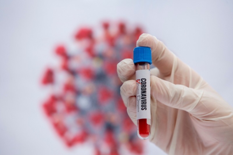 씨엘바이오, 코로나 잡는 '피톤치드' 기업서 러브콜 쇄도