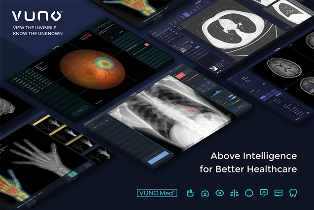 뷰노 참고 이미지