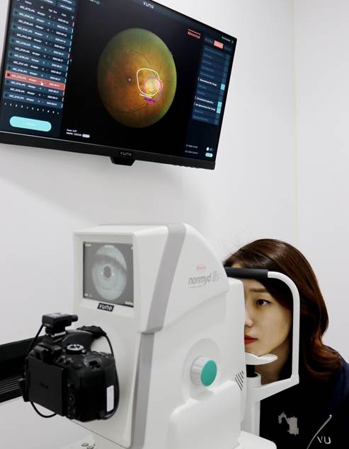 참고사진: 뷰노메드 펀더스 AI™ 체험 사진