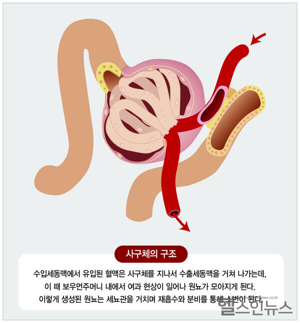 강동경희대학교병원제공,사구체설명그림자료
