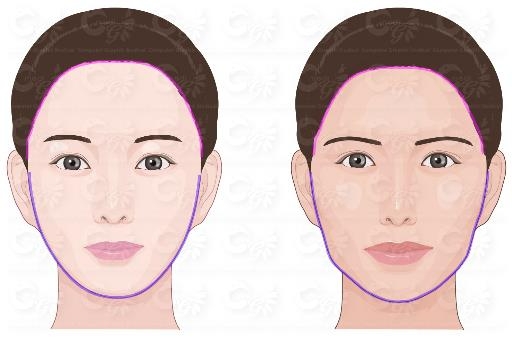 왼쪽은 한국인이 선호하는 얼굴, 오른쪽은 파라과이인이 선호하는 얼굴 <사진=서울성모병원>