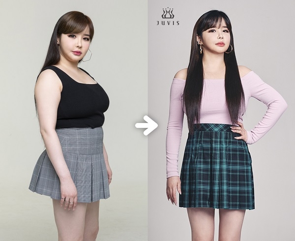 박봄 70kg→59kg 감량…"11kg 다이어트 후 약 줄일 정도로 좋아져"