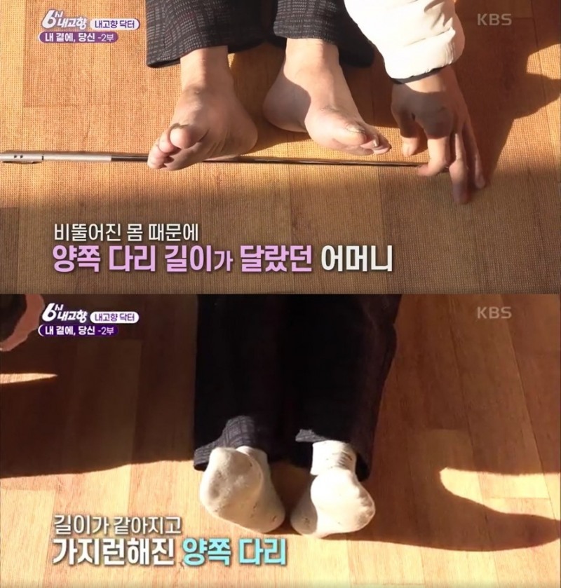 KBS 1TV 6시 내고향 ‘떴다! 내고향 닥터’ 방송 캡쳐 이미지