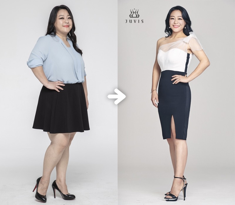 ‘복면가왕’ 보물상자 정체는 역시나 이영현 33kg 다이어트 성공한 모습 화제