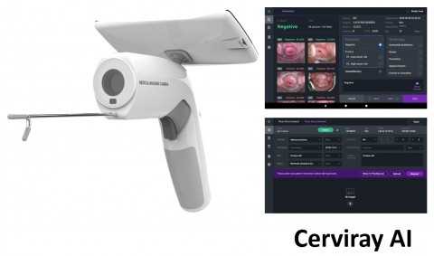 아이도트, 필리핀 CerviQ와 2000만 달러 수출 계약