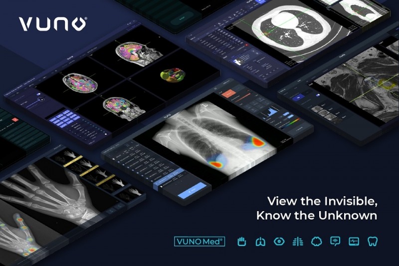 뷰노, 수요예측 경쟁률 1,457대 1…공모가 21,000원 확정