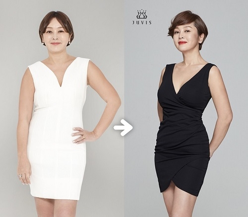 갑상선기능저하 겪은 배우 이승연, 다이어트 성공 소식 알려