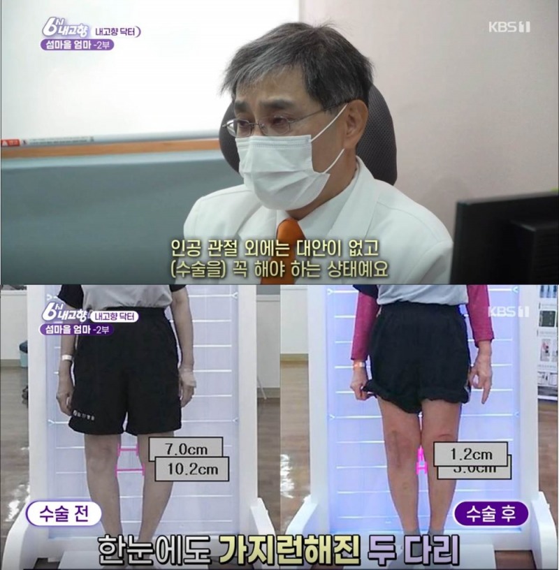 O다리와 휜 허리의 주인공…치료 과정 대공개!