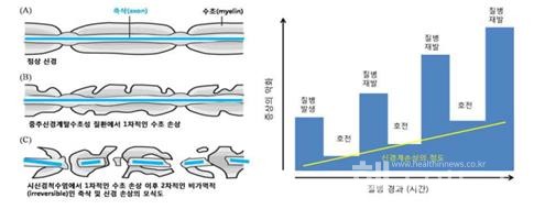 코아스템제공
