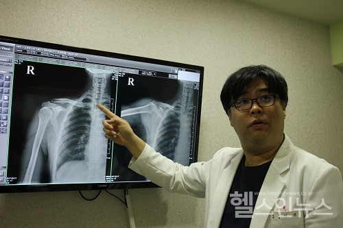 이석참바른의원제공,이석원장