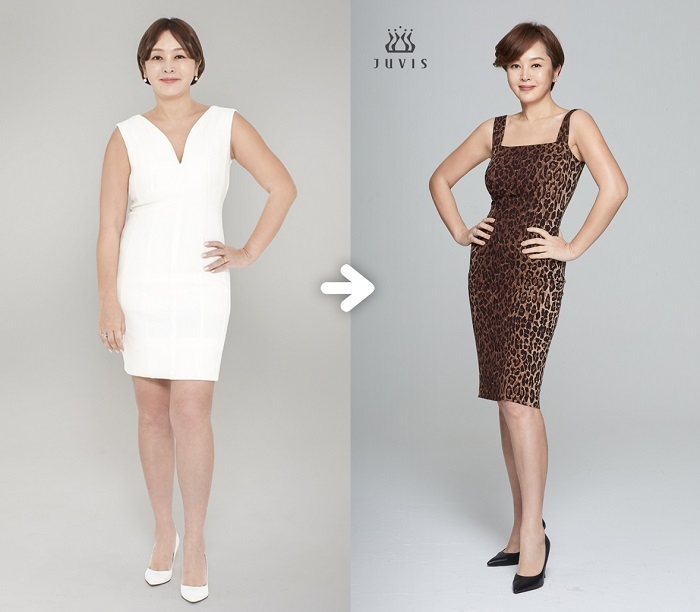 이승연 다이어트 성공, 갑상선기능저하 극복하며 20년 전 의상 거뜬히 소화