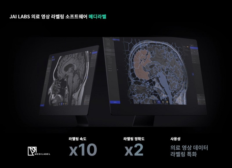 재이랩스, 혁신 기술로 의료AI 첨단화 이끈다!