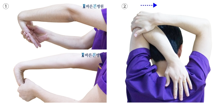 사진제공=바른본병원