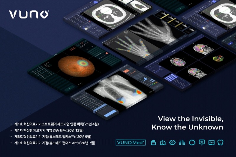 뷰노, 국내 1호 혁신의료기기소프트웨어 제조기업 인증 획득