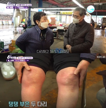 4월20일 KBS 1TV 6시 내고향 ‘떴다! 내고향 닥터’ 방송 캡처 이미지