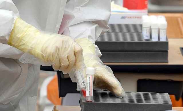 광주·전남 '산발 감염 연속' 닷새째 두 자릿수 16명 확진