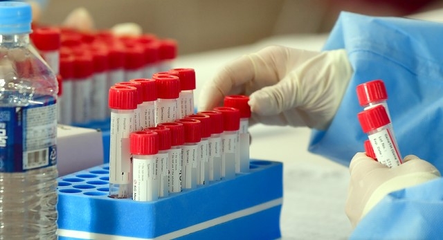 광주·전남 각 4명씩 8명 확진...'자가격리·양파 수확작업'