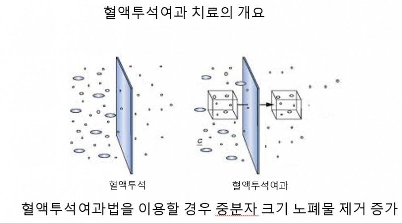 대한신장학회, 혈액투석여과법 활성화 박차