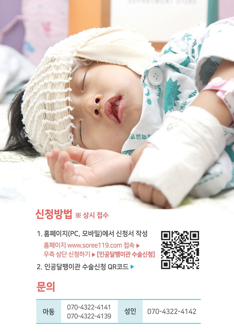 사랑의달팽이, 청각장애인 인공달팽이관 수술 지원