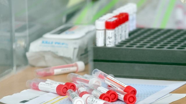 충북, 청주 4명 추가 확진…누적 1445명