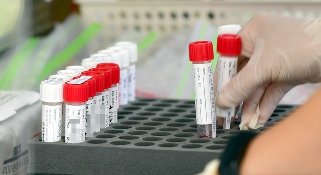 광주, 유흥업소 관련 3명 등 16명 추가…누적 3302명