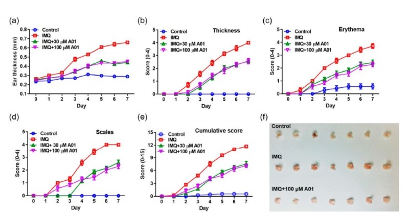 경기도 지원으로 난치병인 건선치료의 길이 열렸다.사진=경기도제공