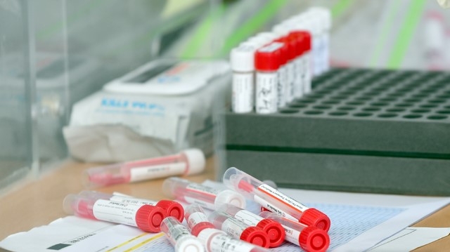 광주 '개학 맞은 고교서 연쇄 감염'...하루 33명 확진