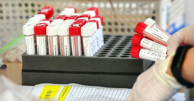 광주·전남, 가족·지인·직장 동료 접촉 후 확진 47명