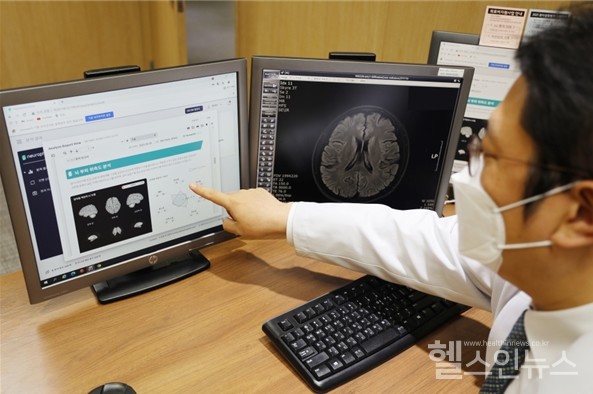 가톨릭대학교여의도성모병워뇌건강센터임현국교수가뇌영상소프트웨어를실행후결과화면을분석하고있다.
