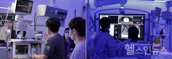 9세소아환자대상내시경초음파유도하췌장가성낭종배액술진행모습.왼쪽마취통증의학과최정현교수,오른쪽소화기내과오치혁교수