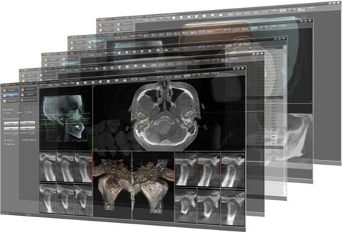 환자 맞춤형 의료기구 제작기업 바이오큐빅스, 베트남 수출 계약 체결