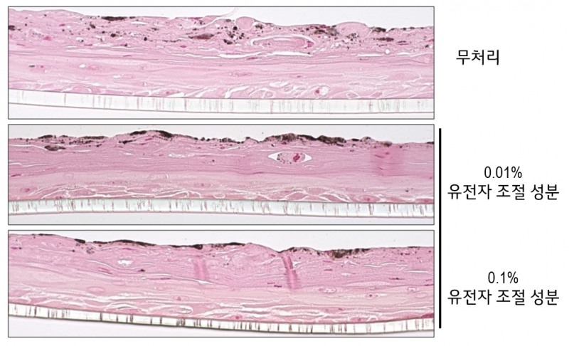LG생활건강, "한국인 피부 색소 침착에 관여하는 유전자 발견"