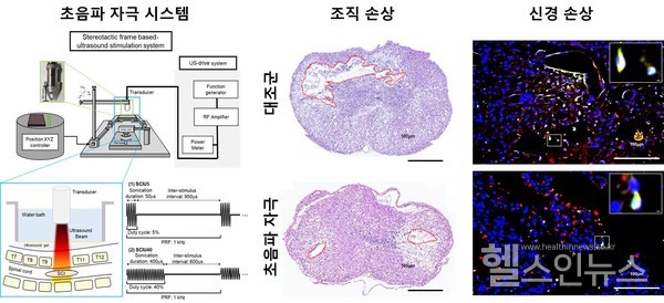 케이메디허브,척수손상동물모델을이용해초음파치료효과확인