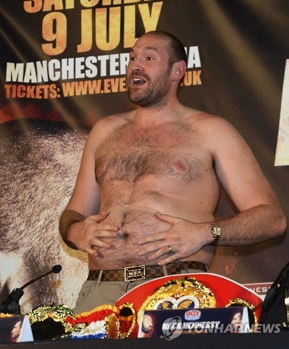 1 게임 418억의 주먹 재벌 타이슨 퓨리(사진=연합)