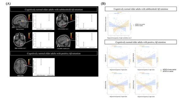 역치 미만 및 역치 이상의 아밀로이드 베타 단백질 침착군에서 아포이4(APOE4) 유전자 유무에 따른 뇌기능 신경망 연결성의 차이 및 기억력, 실행능력과의 연관성. 사진=여의도성모병원