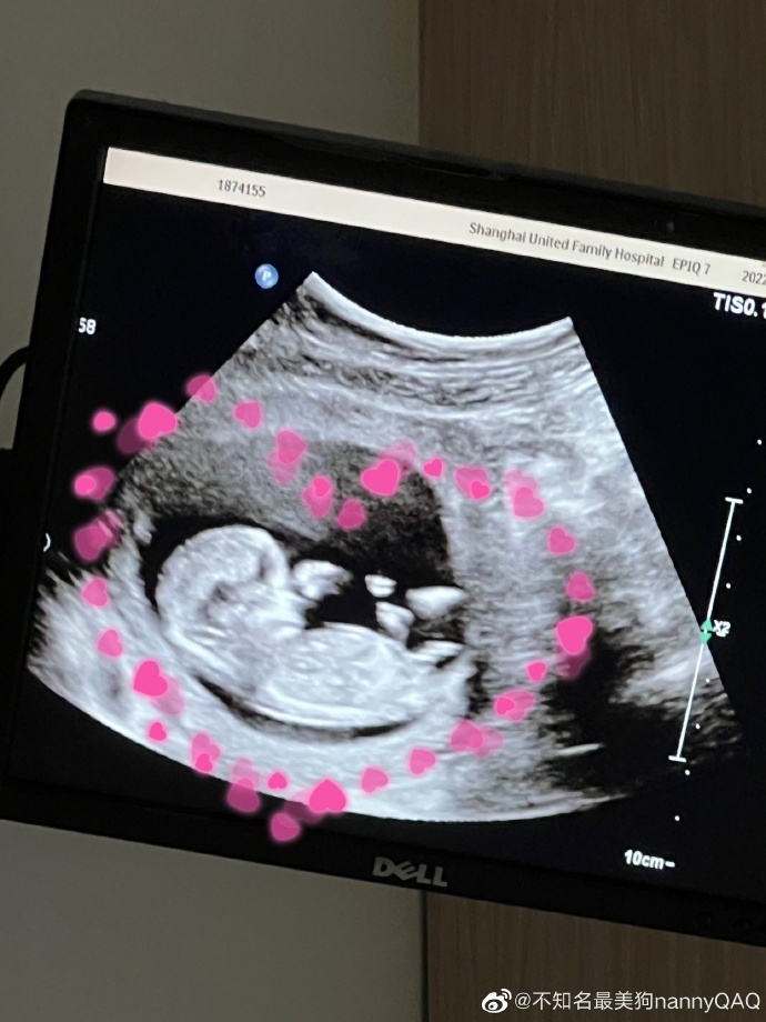 사진='우지'의 약혼녀 '네니'의 SNS.