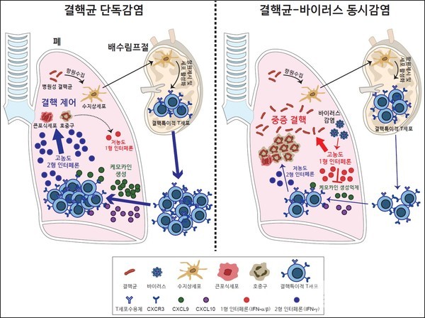 결핵균-바이러스동시감염에의한중증결핵발생기전