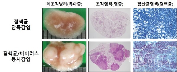 결핵균-바이러스동시감염후중증결핵으로악화된폐병리,단독감염군과비교해바이러스동시감염군에서괴사성육아종이동반된중증폐병리와광범위한폐염증이관찰됐다.