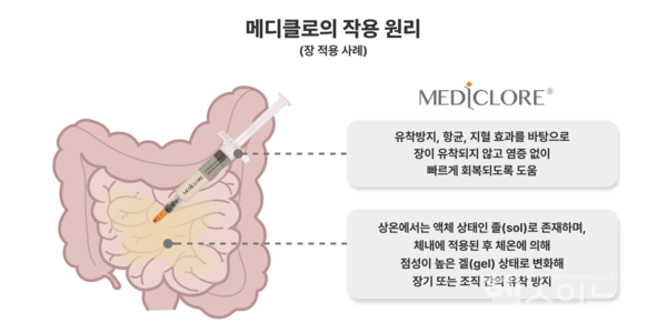메디클로의작용원리(장적용사례)(시지바이오제공)
