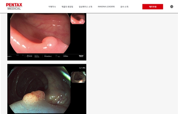 펜탁스 메디칼, IMAGINA 홈페이지 개편 및 리뉴얼 오픈