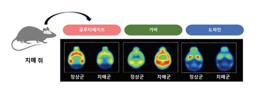알츠하이머치매실험쥐양전자방출단층촬영술(PET)에서아밀로이드,가바의방사성의약품섭취가정상군보다높았고,글루타메이트,도파민은정상군보다낮은뇌흡수를보였다.