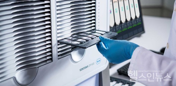 ‘VENTANADP600슬라이드스캐너(VENTANADP600slidescanner)’에검사자가트레이를장착하고있다.