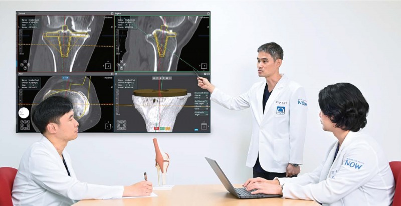 오차 줄인 로봇 인공관절수술, 체력 약한 고령층도 가능하다