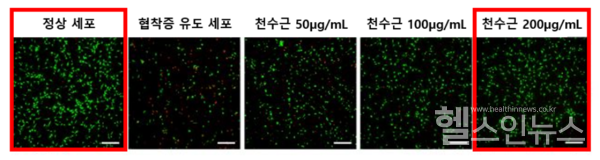 철처리로인해사멸됐던척수세포가천수근의농도에비례해회복됐다.