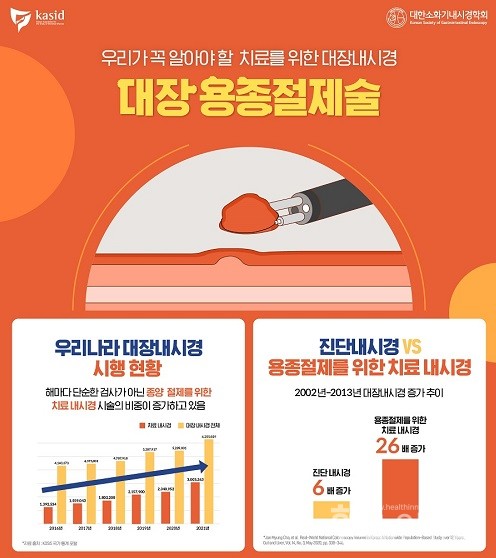 대장용종절제술임포그라피일부