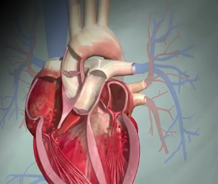 시너지에이아이, 심방세동 치료 ‘인공지능 헬스케어’ 솔루션 발표
