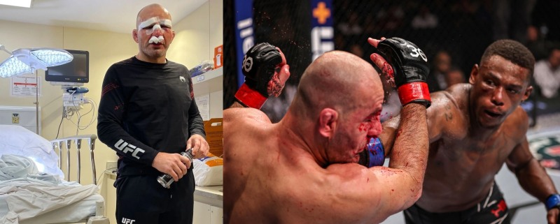 얼굴을 붕대로 감싼 테세이라(왼쪽)와 경기 중 힐에게 가격당하는 테세이라(사진=인스타그램. UFC)