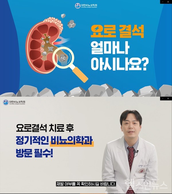 대한비뇨의학회'요로결석얼마나아시나요'유튜브동영상