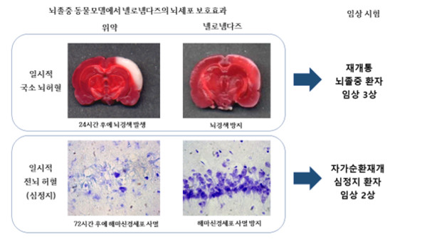 지엔티파마,뇌졸중동물모델에서넬로넴다즈의뇌세포보호효과